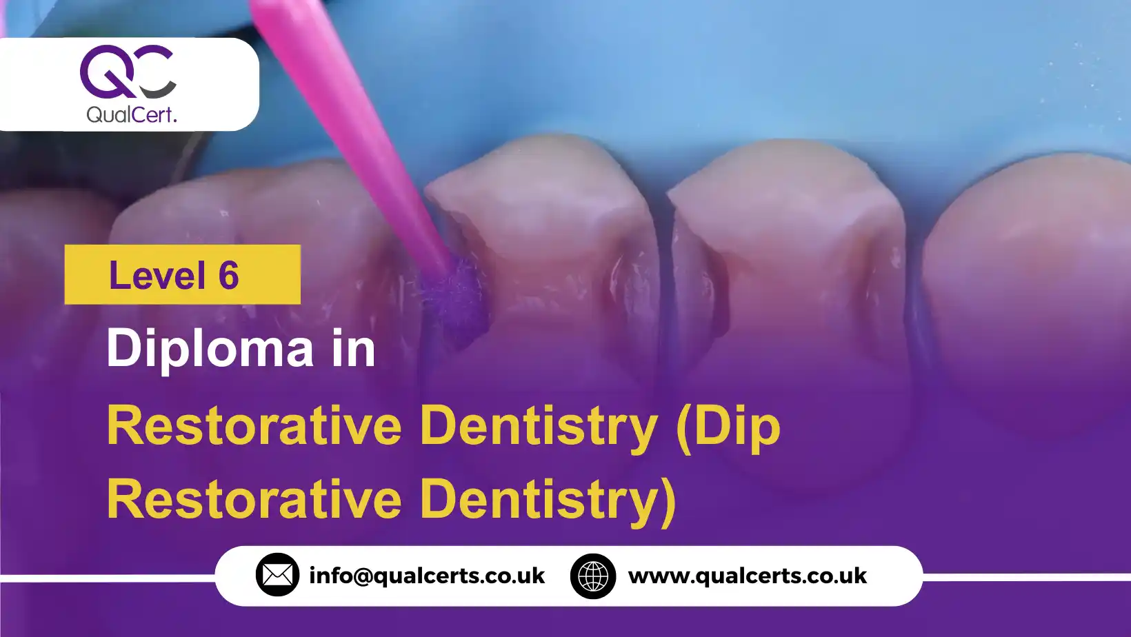 QualCert Level 6 Diploma in Restorative Dentistry (Dip Restorative Dentistry)